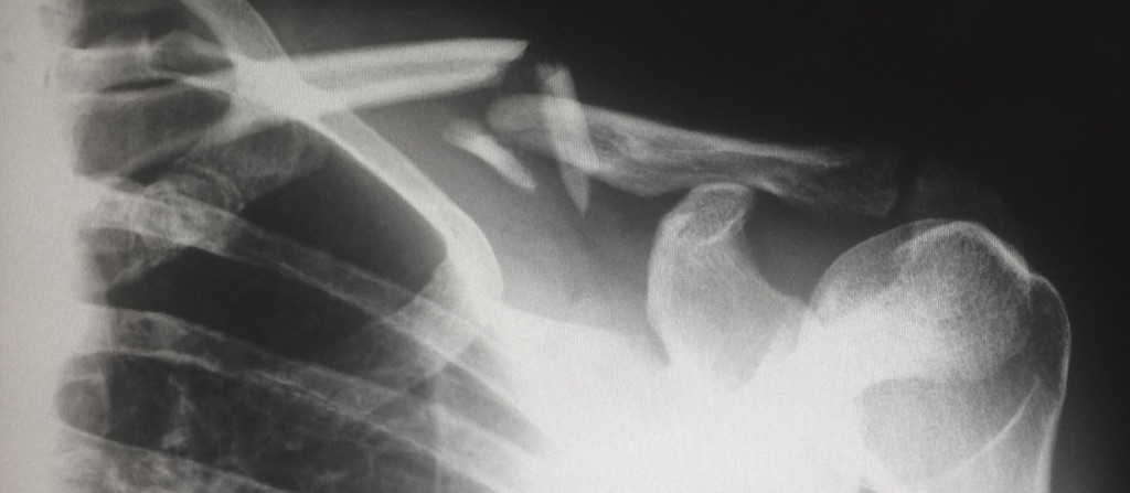 Dreadful attack along the Rochdale&nbsp;Canal